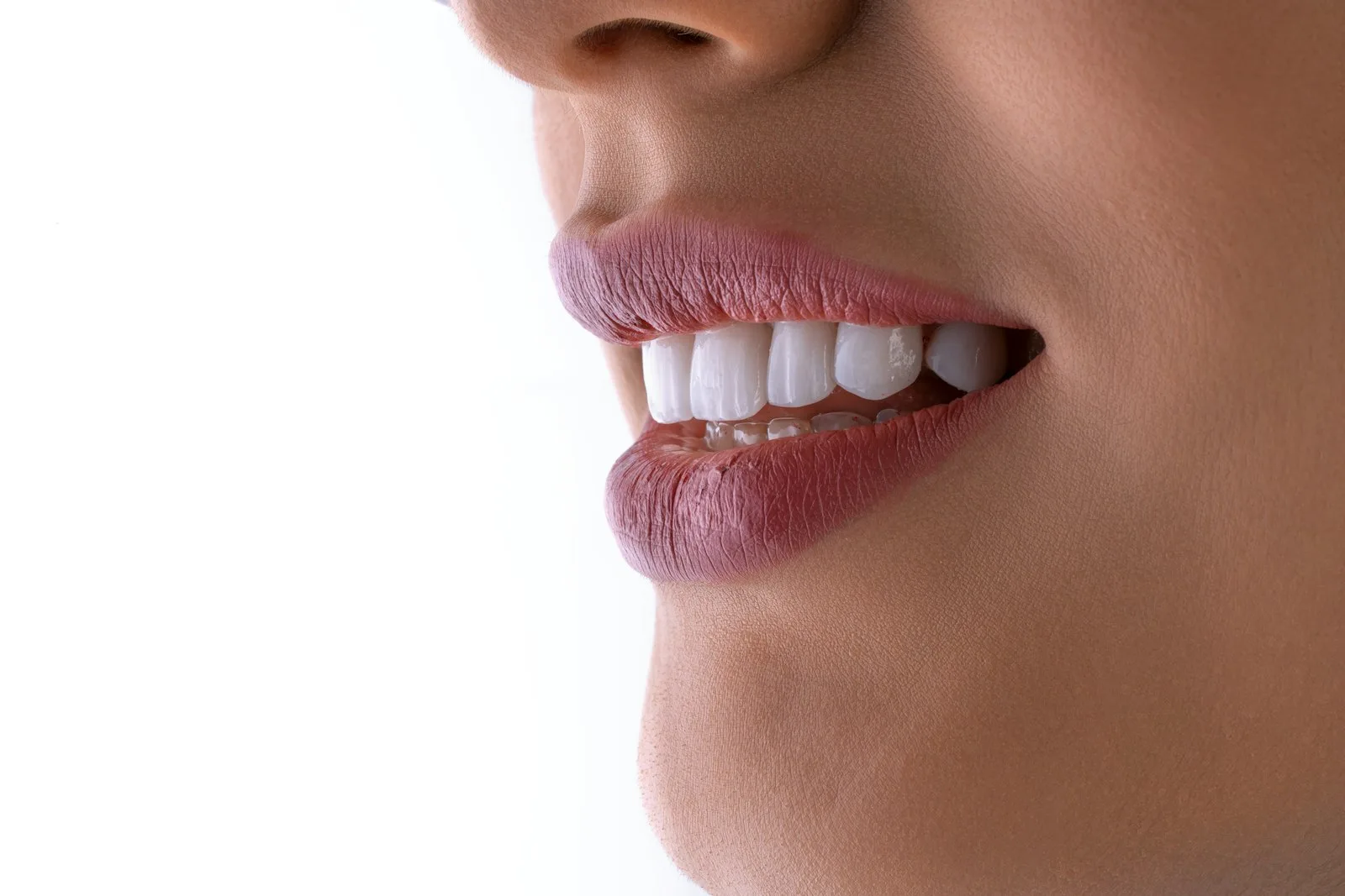 Hollywood Smile
