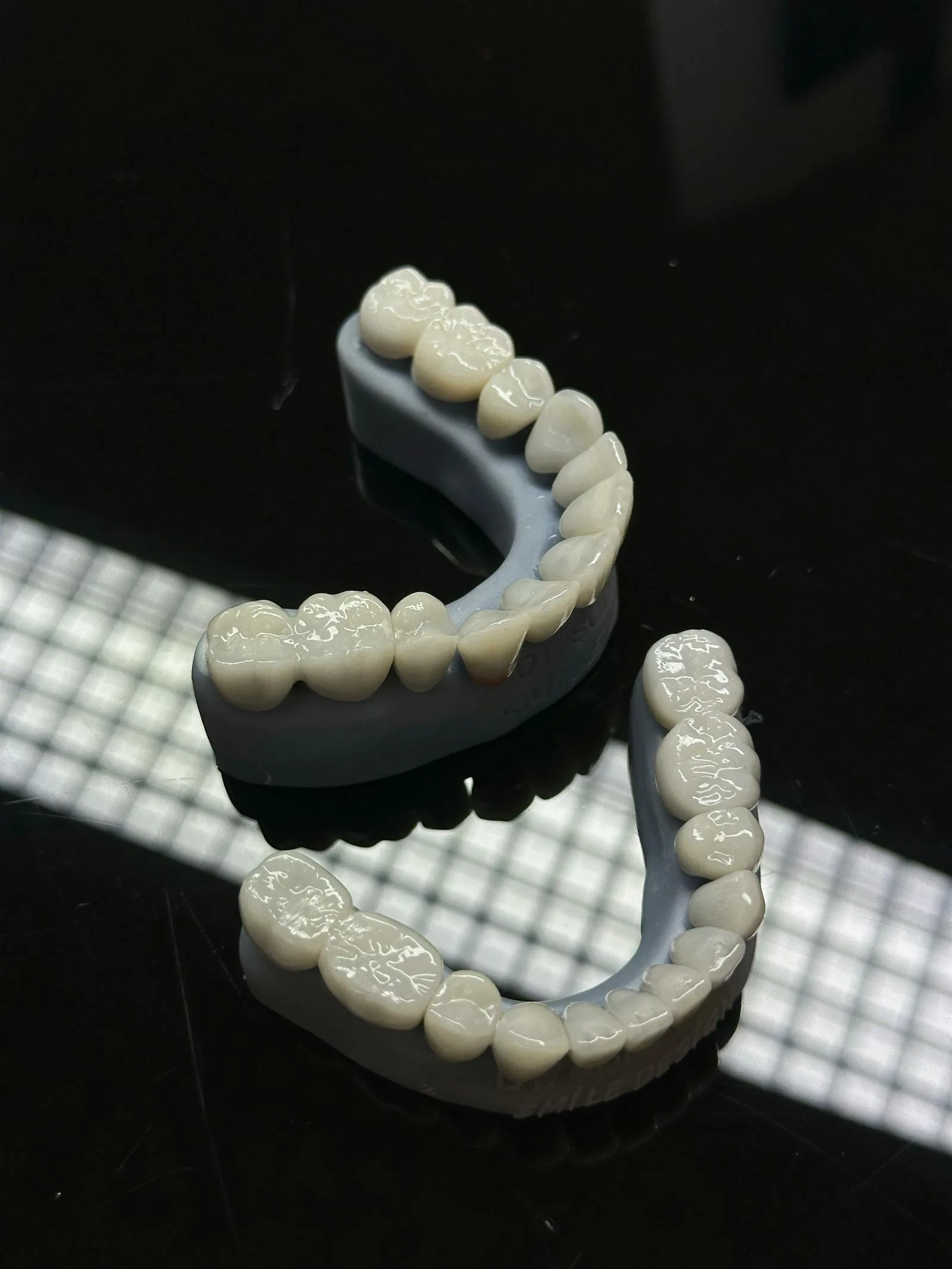 Porcelain Veneers